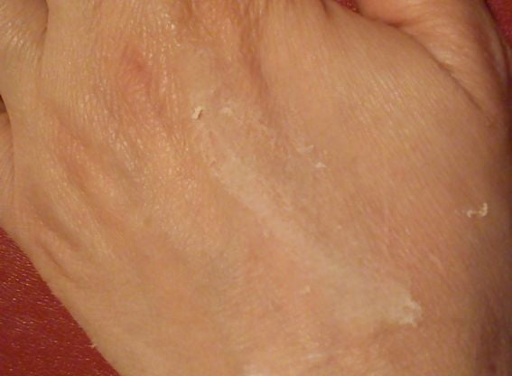 rexaline_hydra_zoom_detail_3